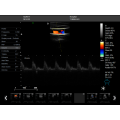 Ultrason médical 3D de Doppler avec le transducteur et le scanner doppler de navire